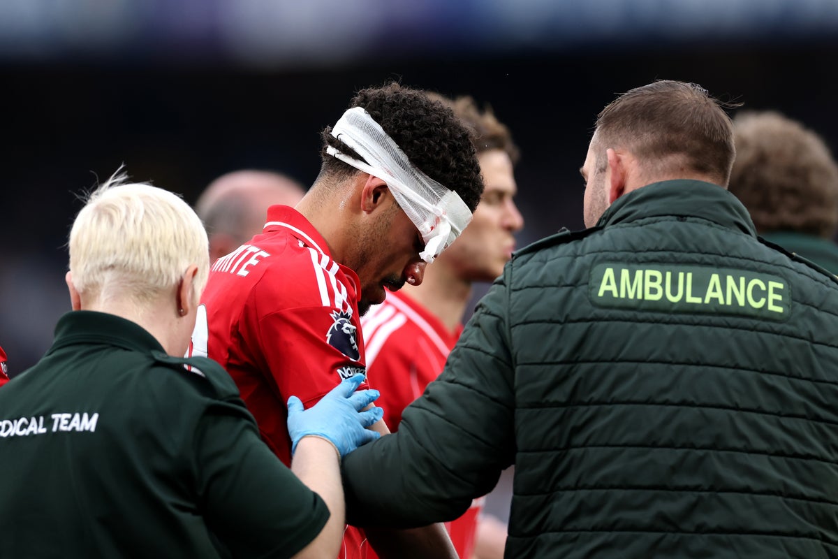 Morgan Gibbs-White could wear face mask for Europa League semi-final after suffering nasty injury