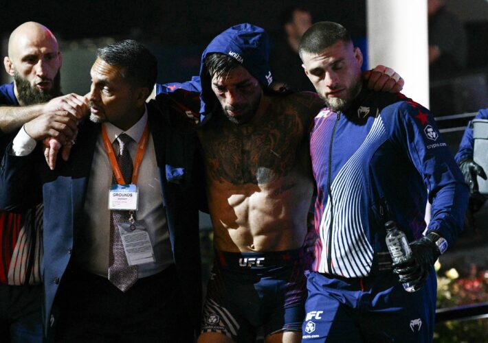 Ilia Topuria shares facial injury update after hiding UFC wounds for six weeks